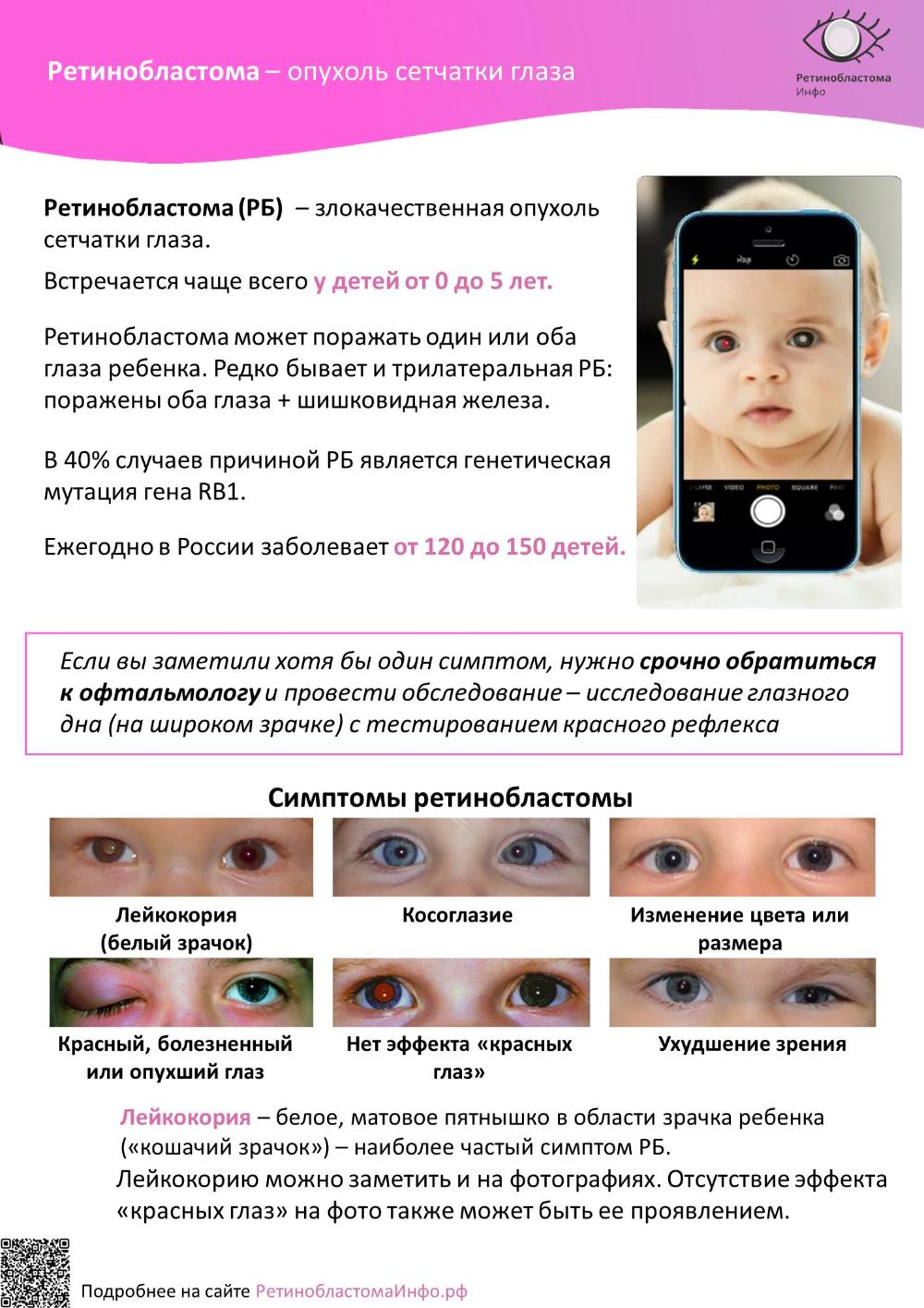 Ретинобластома: неделя, которая спасает детские глаза